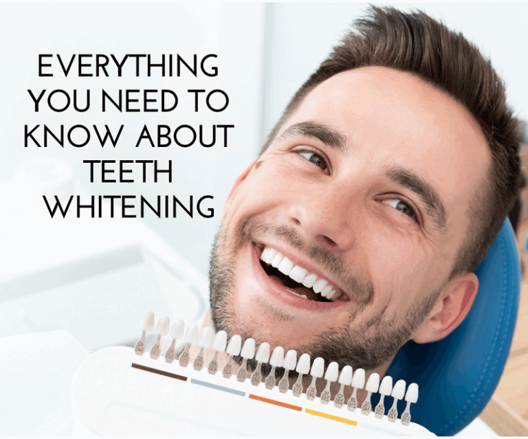 Everything-You-Need-to-Know-About-Teeth-Whitening
