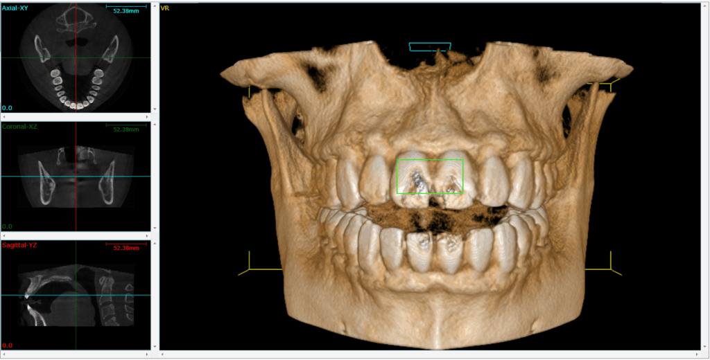 Philadelphia Cone Beam 3D Imaging