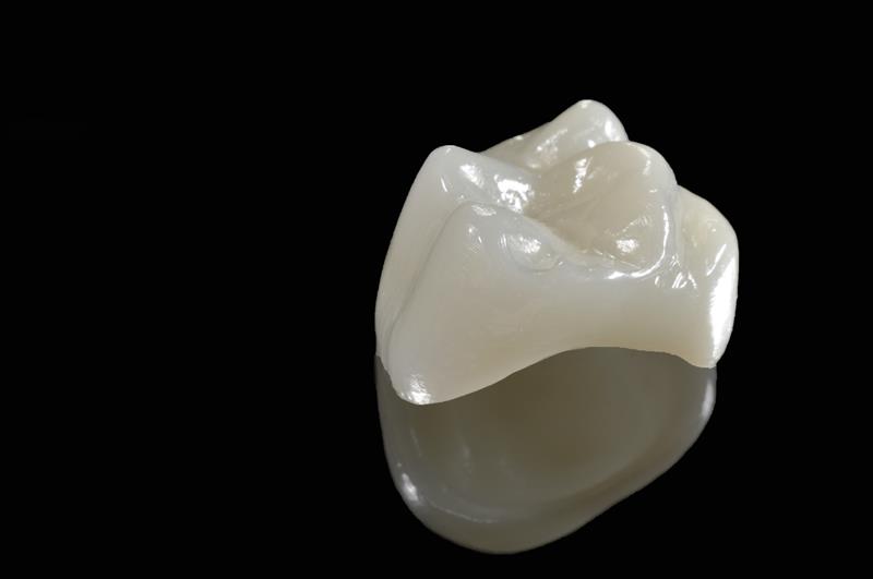 Philadelphia Porcelain Crowns